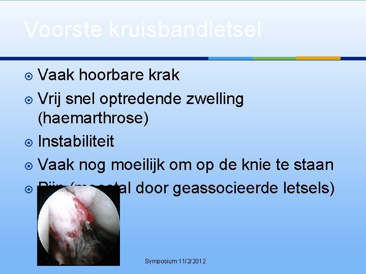 Voorste kruisbandletsel Vaak hoorbare krak Vrij snel optredende zwelling (haemarthrose) Instabiliteit Vaak nog moeilijk