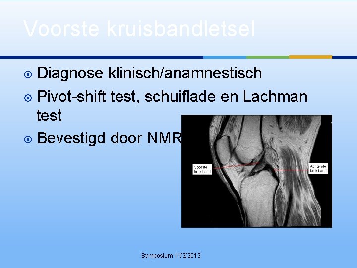 Voorste kruisbandletsel Diagnose klinisch/anamnestisch Pivot-shift test, schuiflade en Lachman test Bevestigd door NMR Symposium