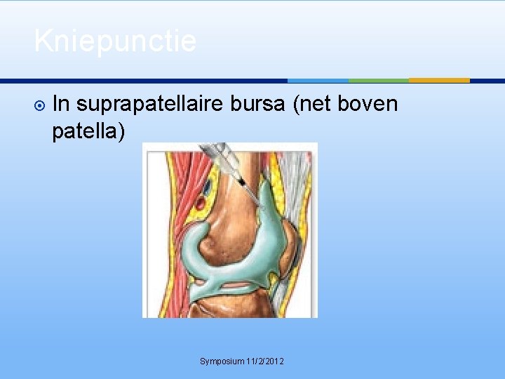 Kniepunctie In suprapatellaire bursa (net boven patella) Symposium 11/2/2012 