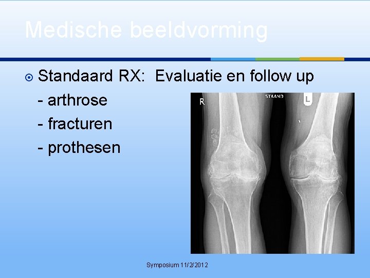 Medische beeldvorming Standaard RX: Evaluatie en follow up - arthrose - fracturen - prothesen