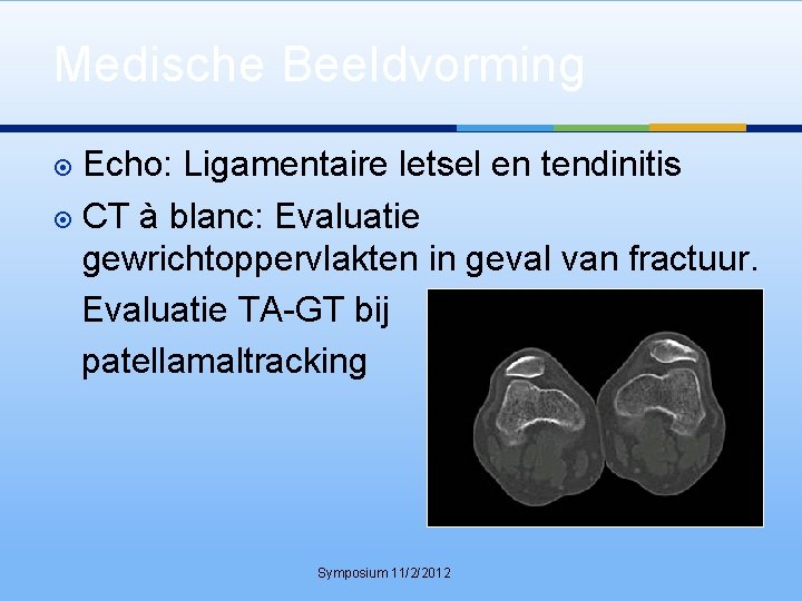 Medische Beeldvorming Echo: Ligamentaire letsel en tendinitis CT à blanc: Evaluatie gewrichtoppervlakten in geval