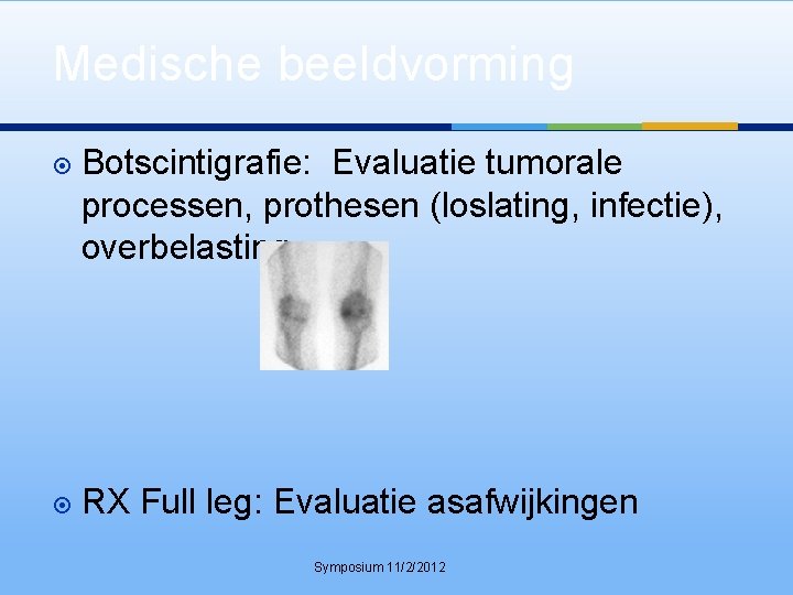 Medische beeldvorming Botscintigrafie: Evaluatie tumorale processen, prothesen (loslating, infectie), overbelasting RX Full leg: Evaluatie