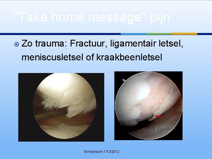 “Take home message” pijn Zo trauma: Fractuur, ligamentair letsel, meniscusletsel of kraakbeenletsel Symposium 11/2/2012