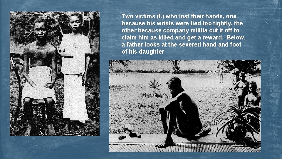 Two victims (l. ) who lost their hands, one because his wrists were tied