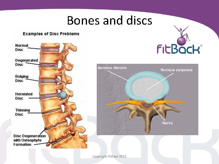 Bones and discs Copyright Fit. Back 2015 