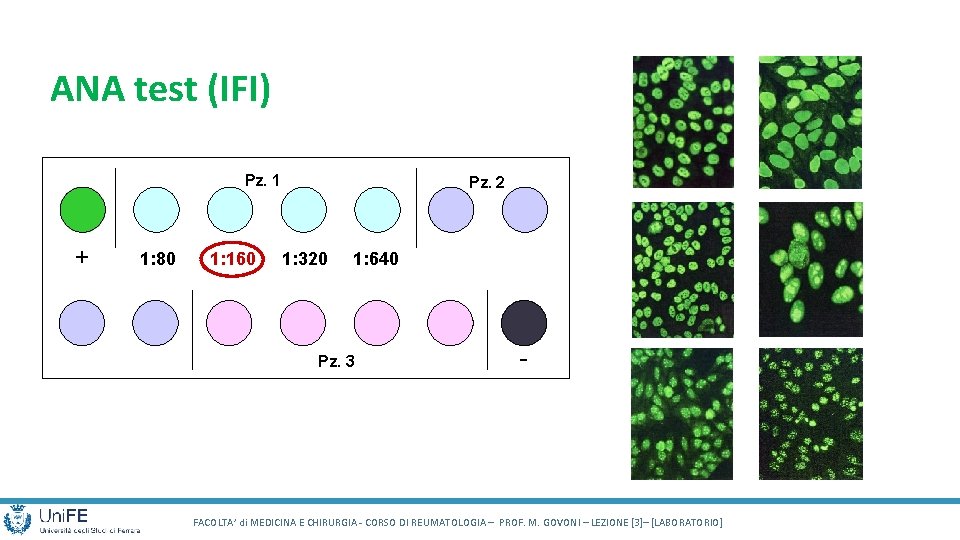 ANA test (IFI) Pz. 1 + 1: 80 1: 160 Pz. 2 1: 320