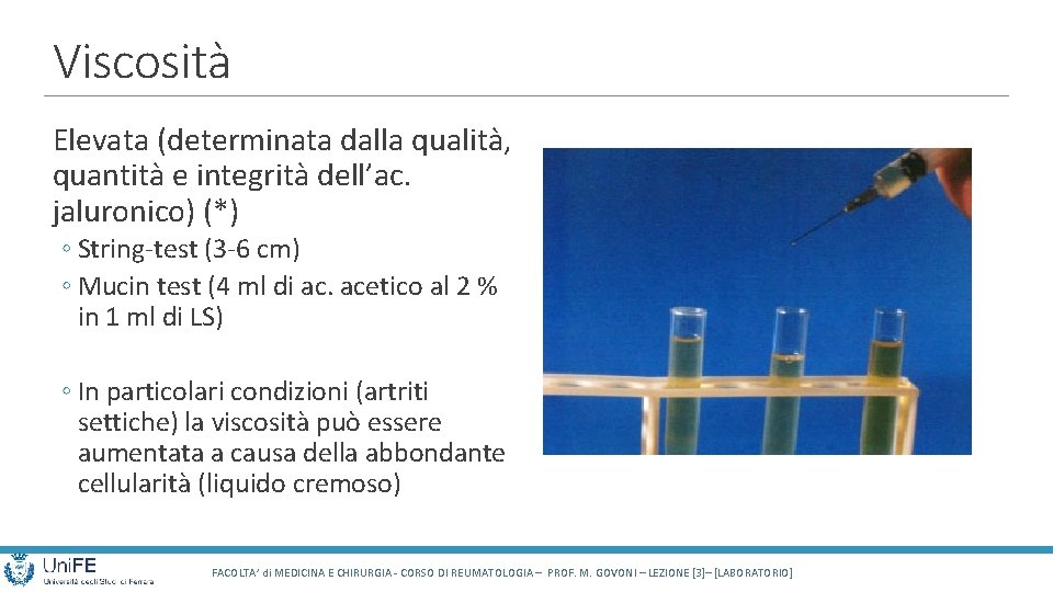 Viscosità Elevata (determinata dalla qualità, quantità e integrità dell’ac. jaluronico) (*) ◦ String-test (3