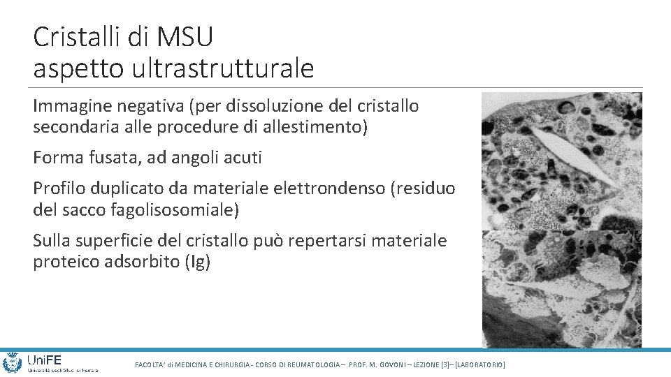 Cristalli di MSU aspetto ultrastrutturale Immagine negativa (per dissoluzione del cristallo secondaria alle procedure
