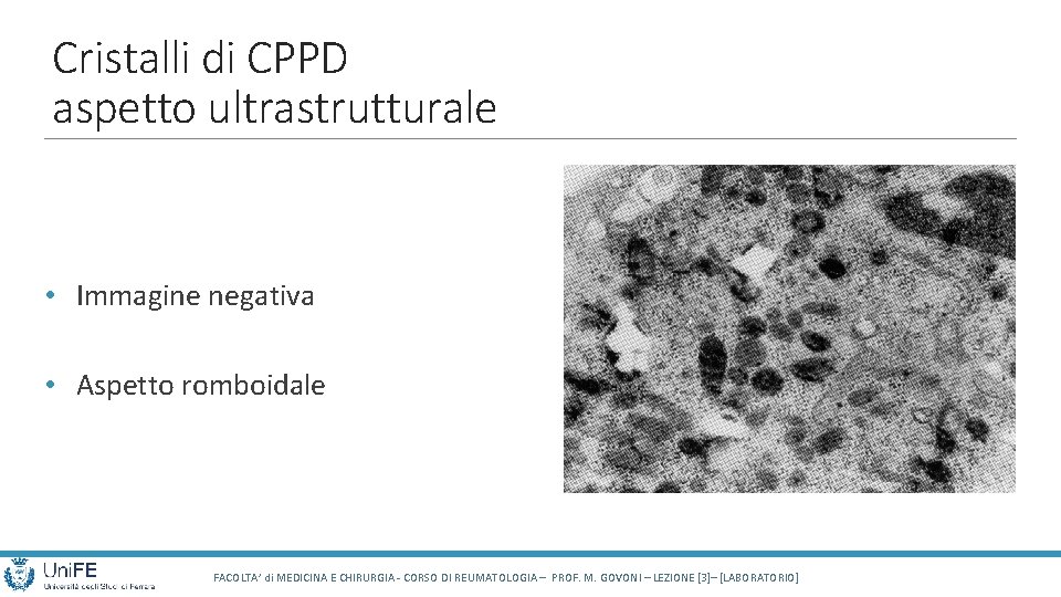 Cristalli di CPPD aspetto ultrastrutturale • Immagine negativa • Aspetto romboidale FACOLTA’ di MEDICINA