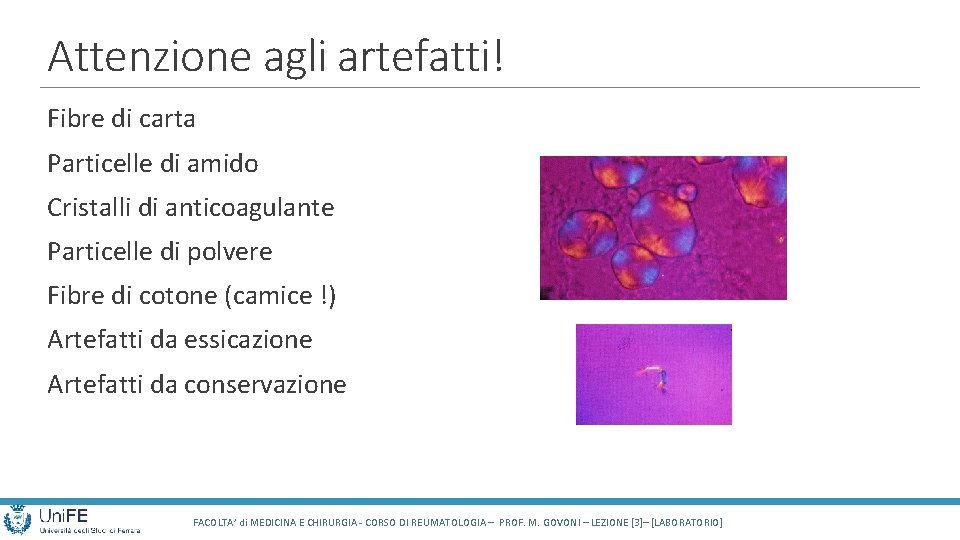 Attenzione agli artefatti! Fibre di carta Particelle di amido Cristalli di anticoagulante Particelle di