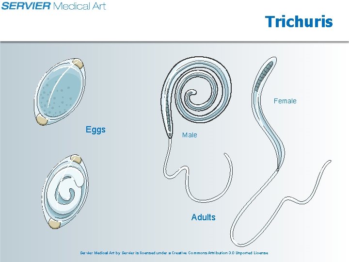 Trichuris Female Eggs Male Adults Servier Medical Art by Servier is licensed under a