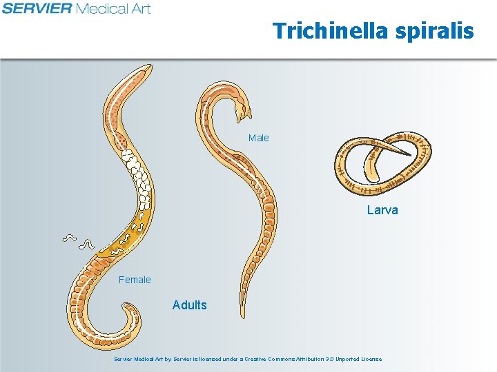 Trichinella spiralis Male Larva Female Adults Servier Medical Art by Servier is licensed under