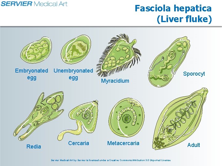 Fasciola hepatica (Liver fluke) Embryonated Unembryonated egg Redia Cercaria Sporocyt Myracidium Metacercaria Servier Medical
