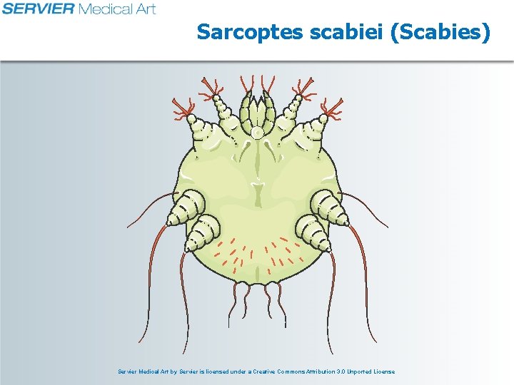 Sarcoptes scabiei (Scabies) Servier Medical Art by Servier is licensed under a Creative Commons