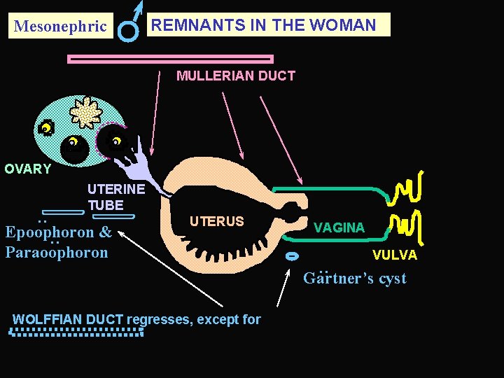 Mesonephric REMNANTS IN THE WOMAN MULLERIAN DUCT OVARY : UTERINE TUBE VAGINA : Epoophoron
