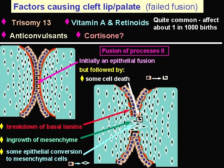 Factors causing cleft lip/palate (failed fusion) Trisomy 13 Vitamin A & Retinoids Quite common