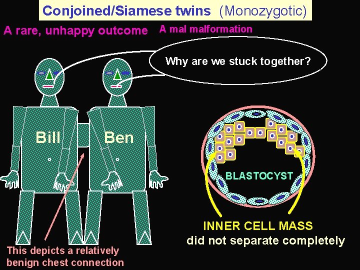 Conjoined/Siamese twins (Monozygotic) A rare, unhappy outcome A malformation Why are we stuck together?