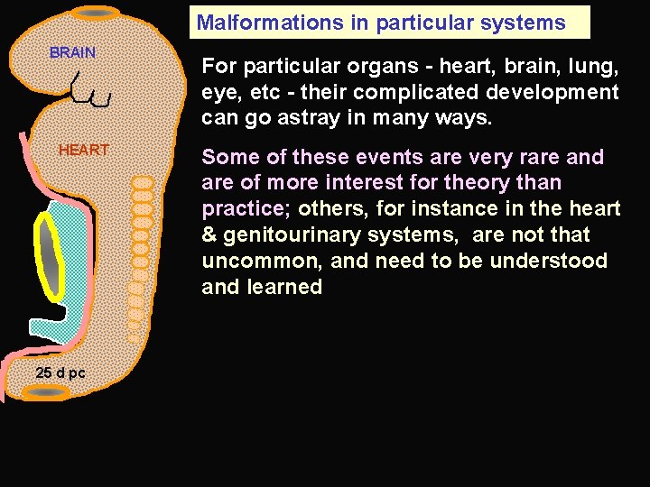 Malformations in particular systems BRAIN HEART 25 d pc For particular organs - heart,