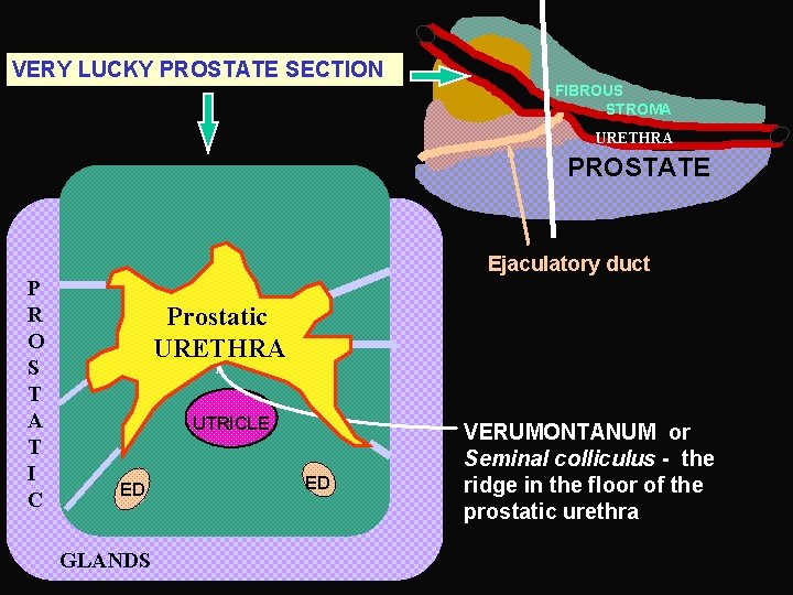 VERY LUCKY PROSTATE SECTION FIBROUS STROMA URETHRA PROSTATE Ejaculatory duct P R O S