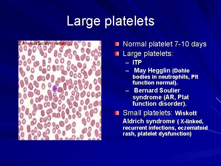 Large platelets Normal platelet 7 -10 days Large platelets: – ITP – May Hegglin