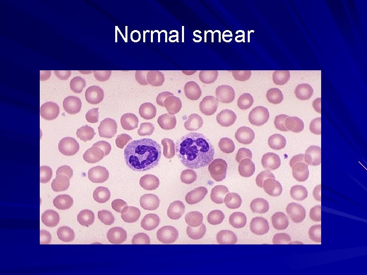 Normal smear 