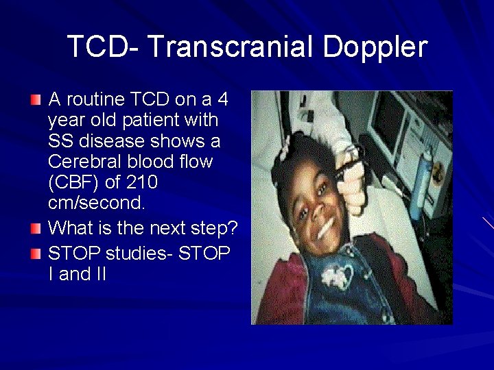 TCD- Transcranial Doppler A routine TCD on a 4 year old patient with SS