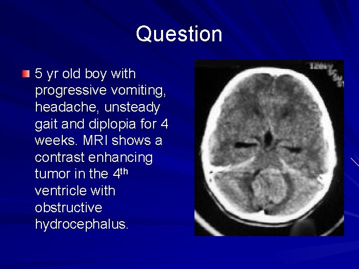 Question 5 yr old boy with progressive vomiting, headache, unsteady gait and diplopia for
