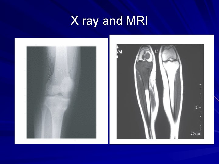 X ray and MRI 
