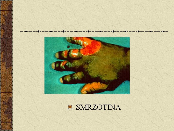  SMRZOTINA 