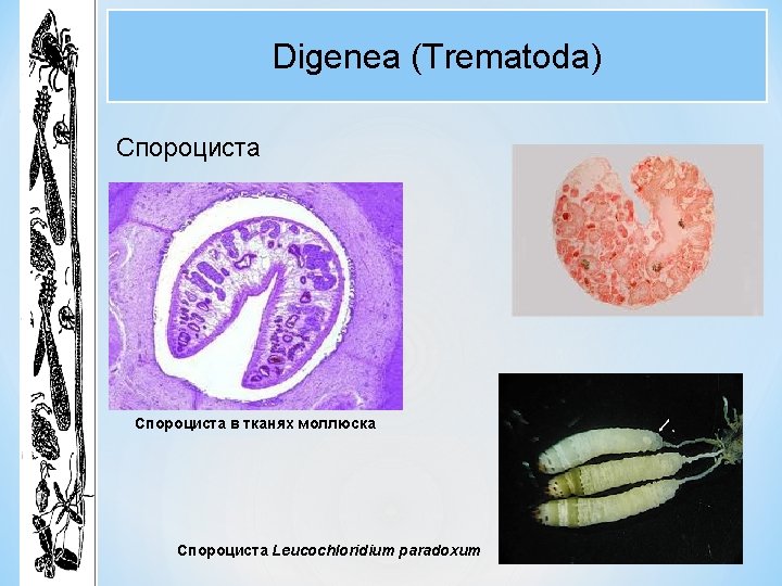 Digenea (Trematoda) Спороциста в тканях моллюска Спороциста Leucochloridium paradoxum Digenea (Trematoda) Спороциста в тканях моллюска Спороциста Leucochloridium paradoxum