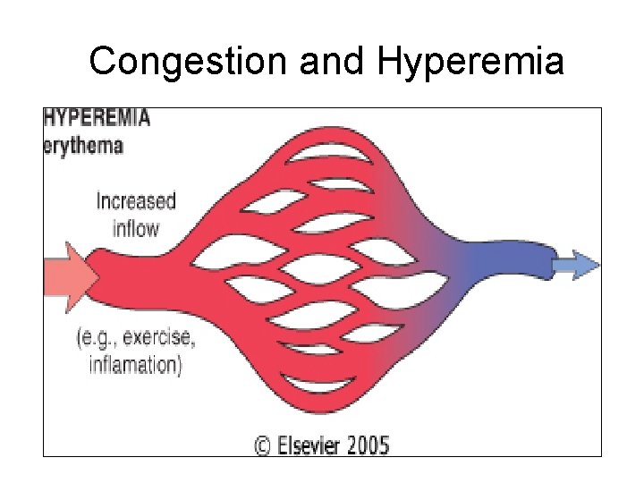 Congestion and Hyperemia 