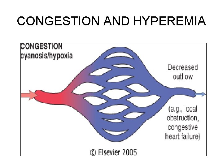 CONGESTION AND HYPEREMIA 