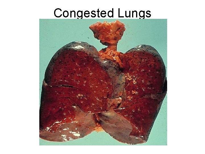 Congested Lungs 