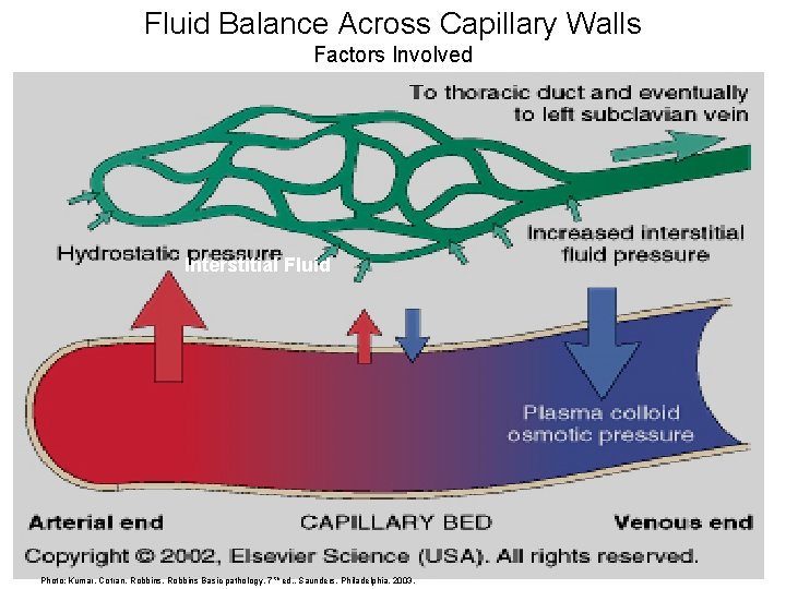Fluid Balance Across Capillary Walls Factors Involved Interstitial Fluid Photo: Kumar, Cotran, Robbins Basic