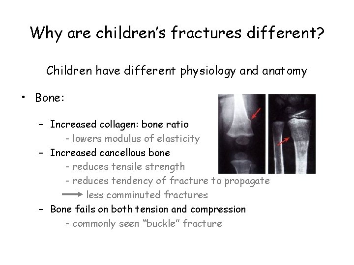 Why are children’s fractures different? Children have different physiology and anatomy • Bone: –