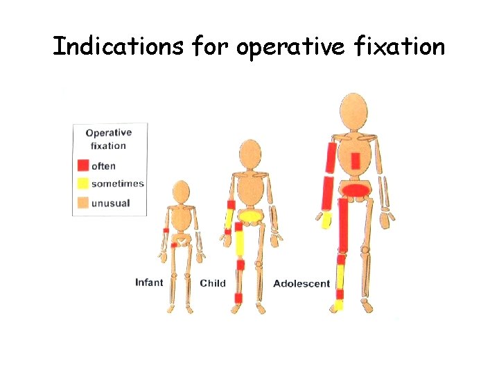 Indications for operative fixation 