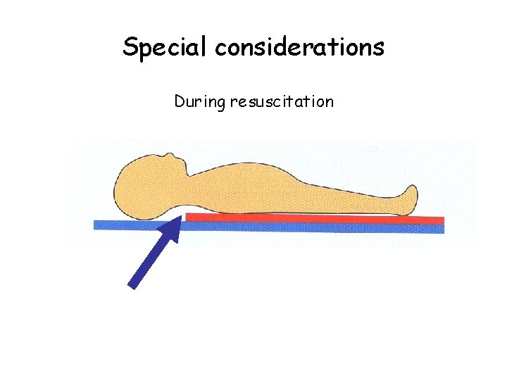 Special considerations During resuscitation 