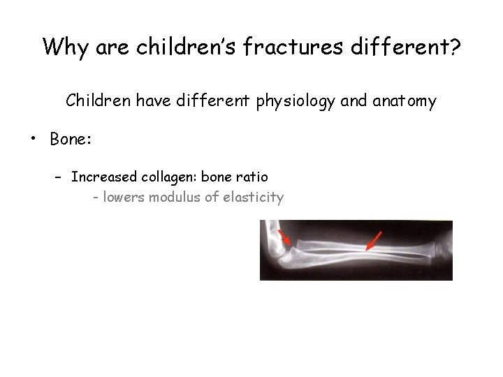 Why are children’s fractures different? Children have different physiology and anatomy • Bone: –