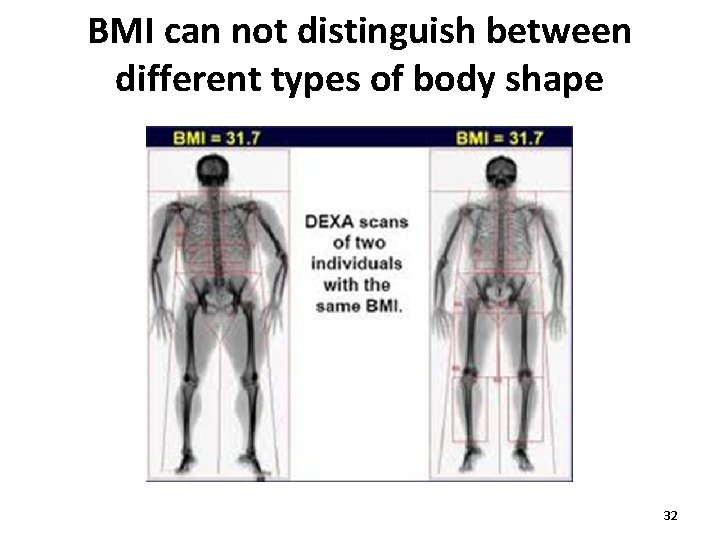 BMI can not distinguish between different types of body shape 32 BMI can not distinguish between different types of body shape 32