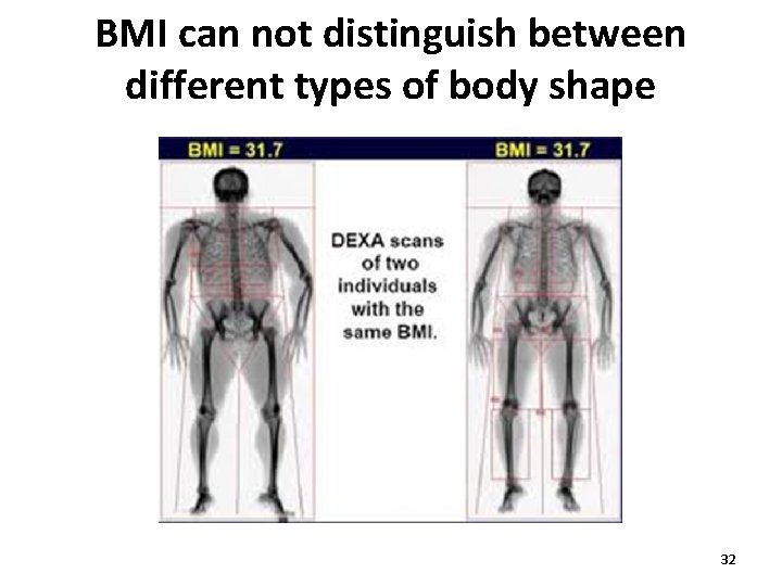 BMI can not distinguish between different types of body shape 32 