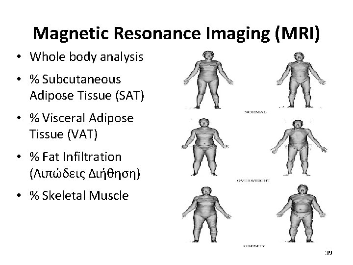 Magnetic Resonance Imaging (MRI) • Whole body analysis • % Subcutaneous Adipose Tissue (SAT) Magnetic Resonance Imaging (MRI) • Whole body analysis • % Subcutaneous Adipose Tissue (SAT)