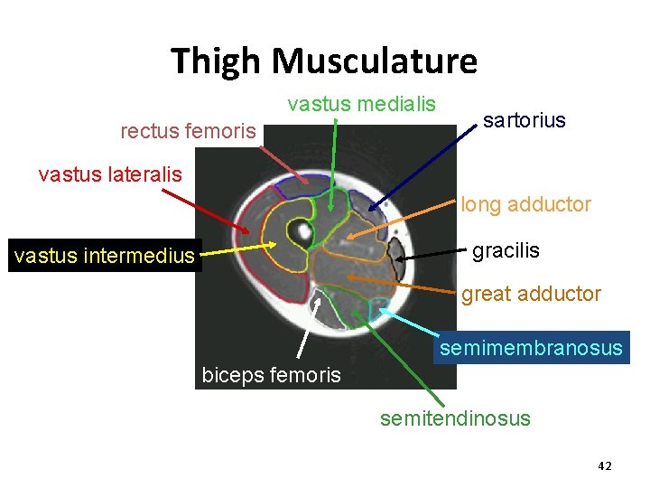 Thigh Musculature vastus medialis rectus femoris sartorius vastus lateralis long adductor gracilis vastus intermedius Thigh Musculature vastus medialis rectus femoris sartorius vastus lateralis long adductor gracilis vastus intermedius