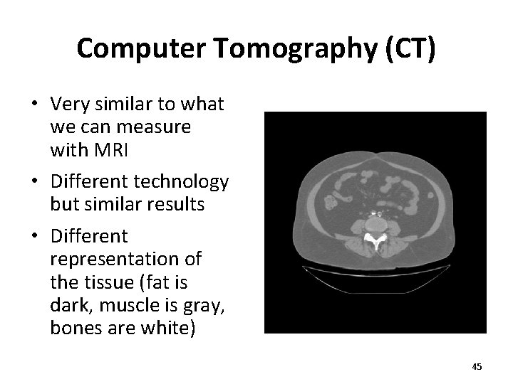 Computer Tomography (CT) • Very similar to what we can measure with MRI •