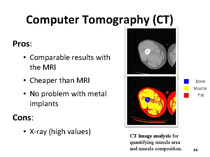 Computer Tomography (CT) Pros: • Comparable results with the MRI • Cheaper than MRI