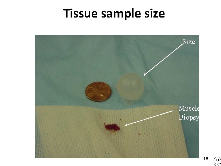 Tissue sample size Voxel Size Muscle Biopsy 49 