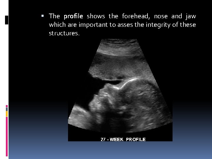  The profile shows the forehead, nose and jaw which are important to asses