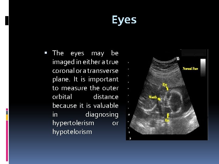 Eyes The eyes may be imaged in either a true coronal or a transverse