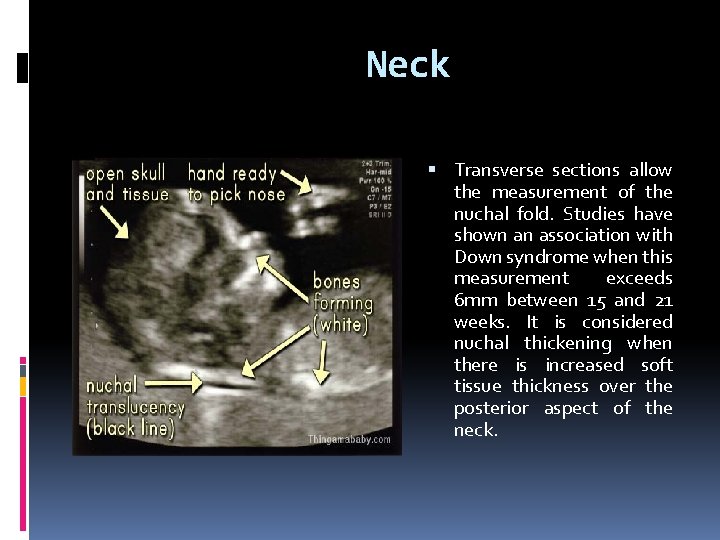 Neck Transverse sections allow the measurement of the nuchal fold. Studies have shown an