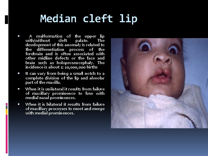 Median cleft lip A malformation of the upper lip with/without cleft palate. The development