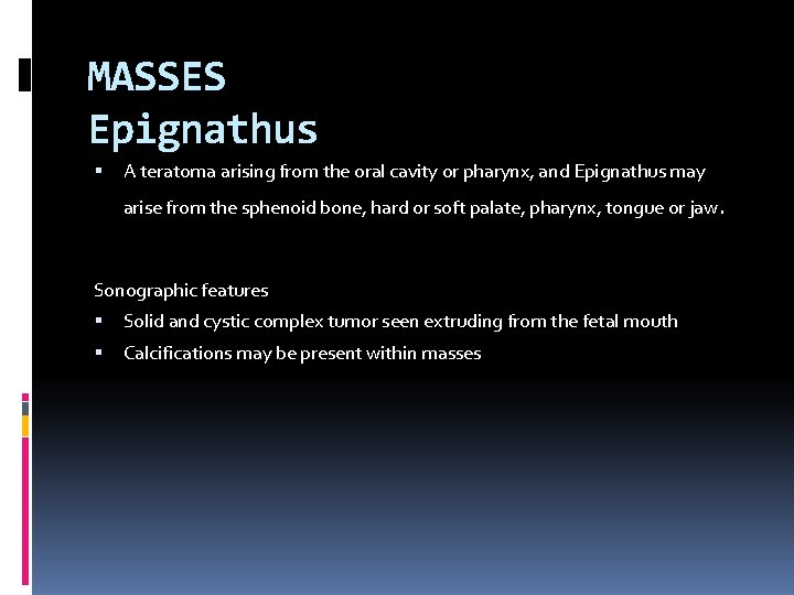 MASSES Epignathus A teratoma arising from the oral cavity or pharynx, and Epignathus may